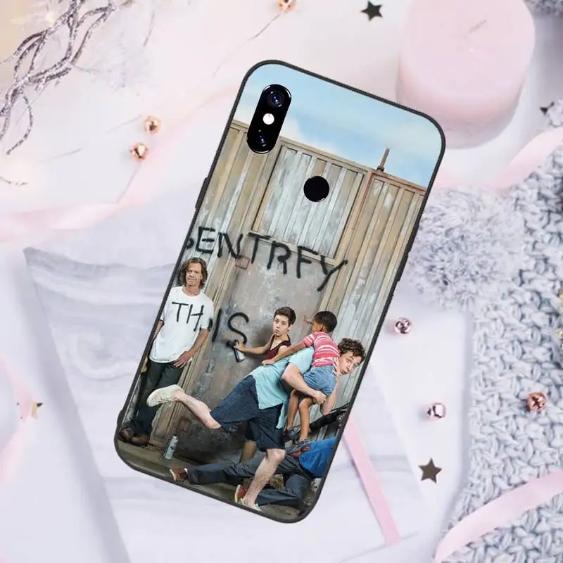 Lip Gallagher Shameless tv show Phone Case For Xiaomi Redmi note 7 8 9 pro 8T 9S Mi Note 10 Lite pro
Lip Gallagher Shameless tv show Phone Case For Xiaomi Redmi note 7 8 9 pro 8T 9S Mi Note 10 Lite pro
