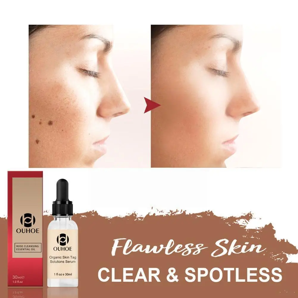 1PC 30g No Trace Painle Skin Repair Essential Oils Face Serum Removal Mole Wart Remover Freckle Cream Painless Mole V6A5
1PC 30g No Trace Painle Skin Repair Essential Oils Face Serum Removal Mole Wart Remover Freckle Cream Painless Mole V6A5