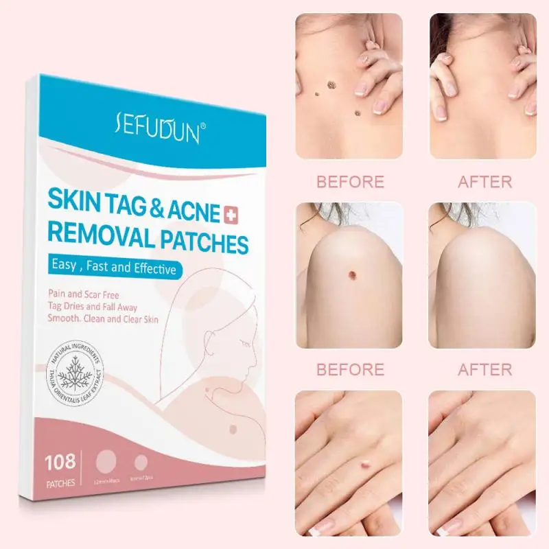 3PCS Acne Pimple Patch Stickers Acne Treatment Pimple Remover Tool Blemish Spot Facial Mask Skin Care Waterproof Stickers
3PCS Acne Pimple Patch Stickers Acne Treatment Pimple Remover Tool Blemish Spot Facial Mask Skin Care Waterproof Stickers