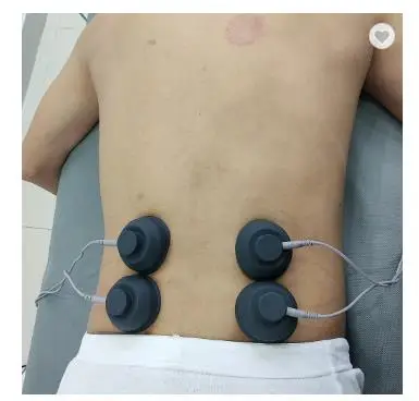 2021 new portable mini home use focused extracorporeal shockwave cellulite shock wave therapy machine ed price equipment
2021 new portable mini home use focused extracorporeal shockwave cellulite shock wave therapy machine ed price equipment