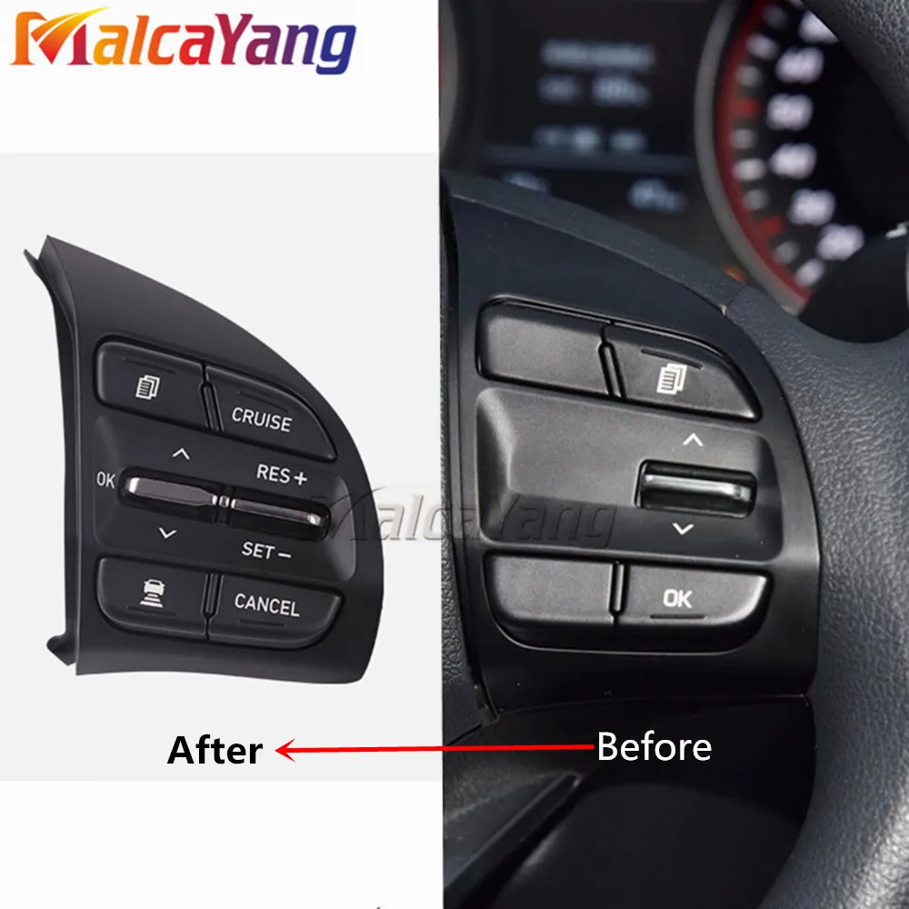 Button For Hyundai Elantra Overseas 2017 GT 2019 Veloster feisi 2018 1.6t Steering Wheel Cruise Control Buttons The Right Side
Button For Hyundai Elantra Overseas 2017 GT 2019 Veloster feisi 2018 1.6t Steering Wheel Cruise Control Buttons The Right Side