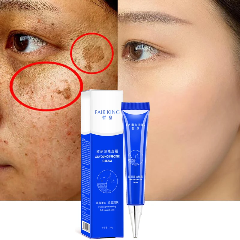 Effective Whitening Freckle Face Cream Korean Cosmetics Hyaluronic Acid Moisturizing Skin Care Melasma Remover Foundation Cream
Effective Whitening Freckle Face Cream Korean Cosmetics Hyaluronic Acid Moisturizing Skin Care Melasma Remover Foundation Cream