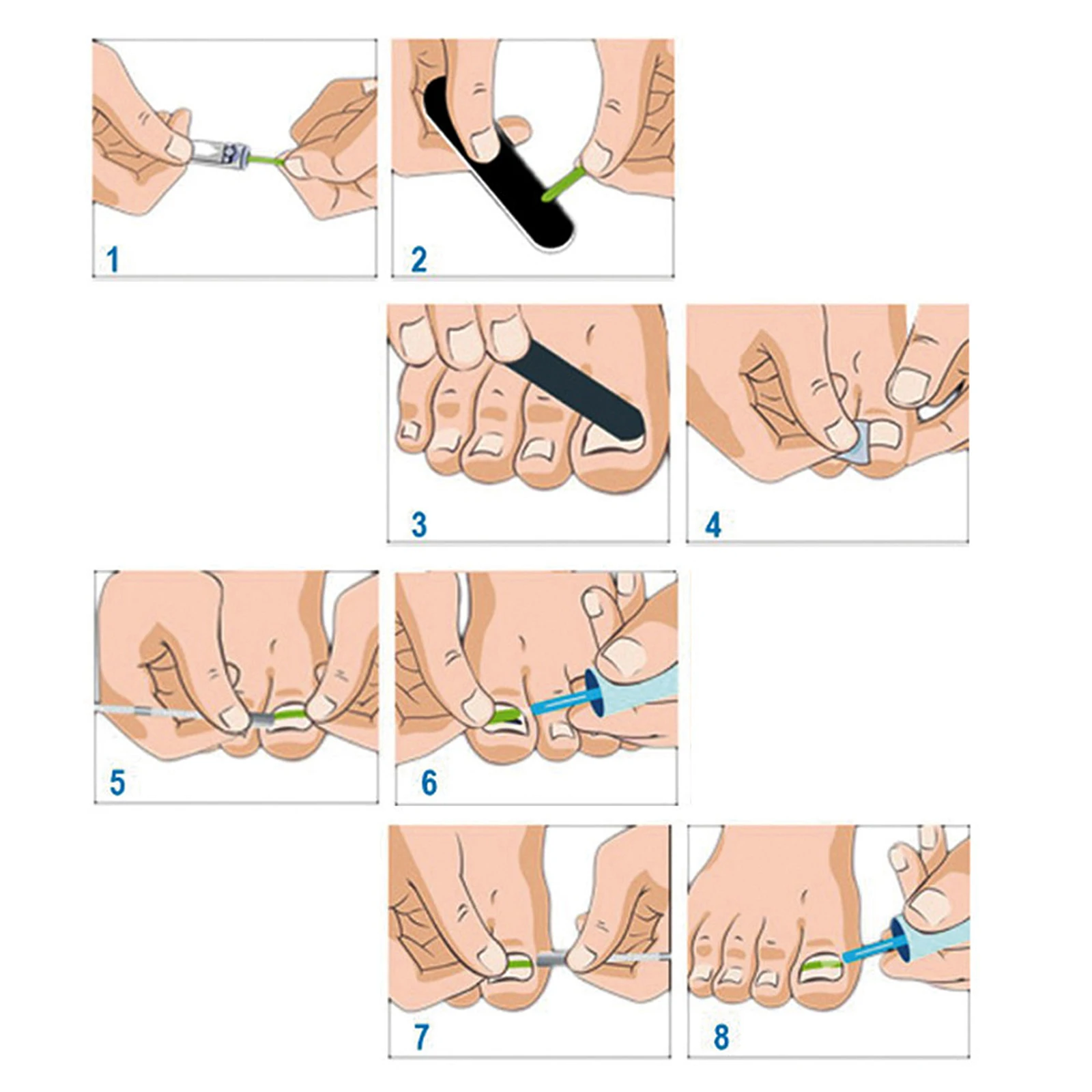 Useful Ingrown Nail Foot Correction Tool Pedicure Toenail Fixer Foot Nail Care Tool Orthotic Nail Corrector Pedicure Tool
Useful Ingrown Nail Foot Correction Tool Pedicure Toenail Fixer Foot Nail Care Tool Orthotic Nail Corrector Pedicure Tool