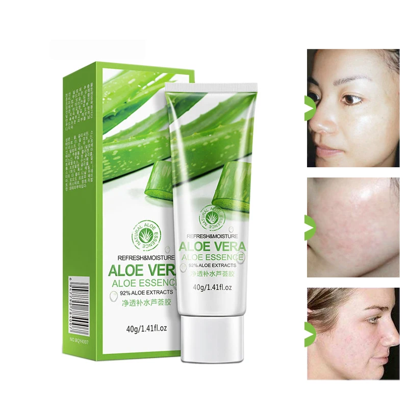 Facial moisturizer for acne