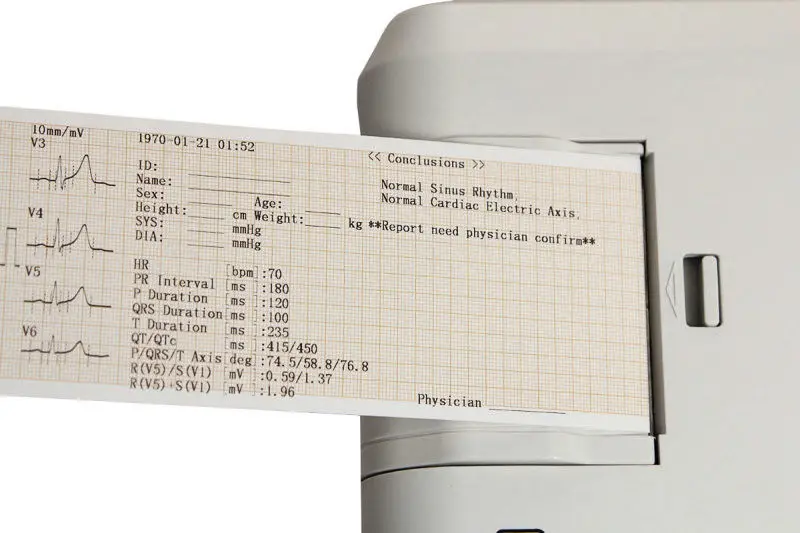 Цифровой Электрокардиограф CONTEC устройство для контроля состояния сердечного
