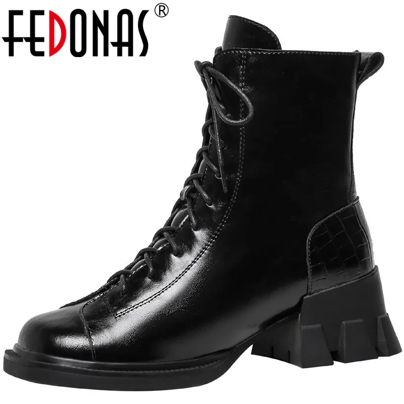 FEDONAS Suede Leather 2021 Woman Snow Boots Women Winter Shoes Cross Tied Thick Heels Ankle Boots Party Basic Shoes Woman Winter
FEDONAS Suede Leather 2021 Woman Snow Boots Women Winter Shoes Cross Tied Thick Heels Ankle Boots Party Basic Shoes Woman Winter