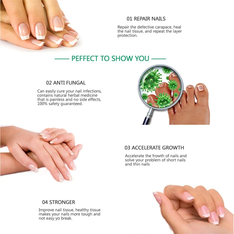 Nail Repair Solution Anti Fungus Onychomycosis Repair Crack Nail Toe Care Essential Liquid NEW Fashion Nature
Nail Repair Solution Anti Fungus Onychomycosis Repair Crack Nail Toe Care Essential Liquid NEW Fashion Nature