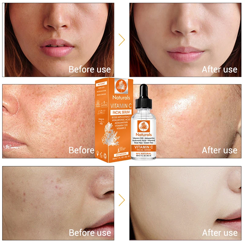 Vitamin C Whitening Serum Hyaluronic Acid Face Cream Remover Freckle Speckle Fade Dark Spots Anti-Aging Skin Care
Vitamin C Whitening Serum Hyaluronic Acid Face Cream Remover Freckle Speckle Fade Dark Spots Anti-Aging Skin Care