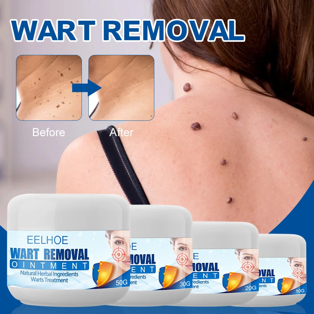 Hot sale Wart Remover Safe Painless Skin Tags Removal Ointment Fast Acting Remover Cream for Warts Moles Corn for All Skins
Hot sale Wart Remover Safe Painless Skin Tags Removal Ointment Fast Acting Remover Cream for Warts Moles Corn for All Skins