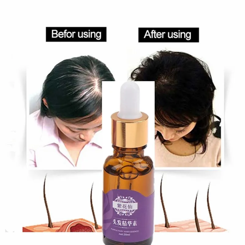 Plant Serum Hair Growth Essential Oils Essence Original Authentic 100% Hair Loss Liquid Health Hair Care Dense Hair Growth Serum
Plant Serum Hair Growth Essential Oils Essence Original Authentic 100% Hair Loss Liquid Health Hair Care Dense Hair Growth Serum