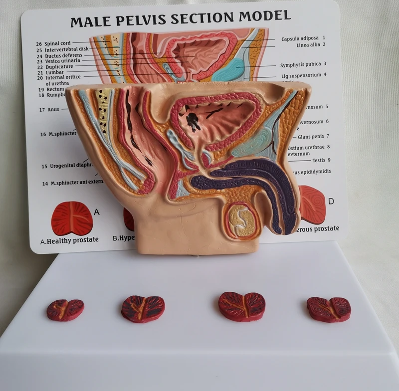 Human Male pelvis section Abdominal Cavity Bladder Prostate Medical Teaching Model Health Illness Comparison Anatomical Model
Human Male pelvis section Abdominal Cavity Bladder Prostate Medical Teaching Model Health Illness Comparison Anatomical Model