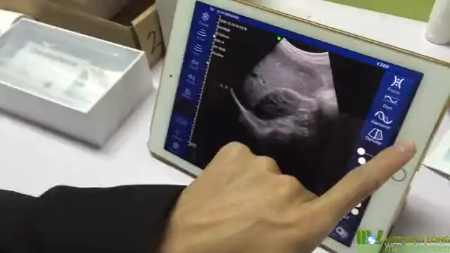 New Released Ultrasound Transducer MSLPU40 for Abdomen Testing / Wireless Ultrasound scanner
New Released Ultrasound Transducer MSLPU40 for Abdomen Testing / Wireless Ultrasound scanner