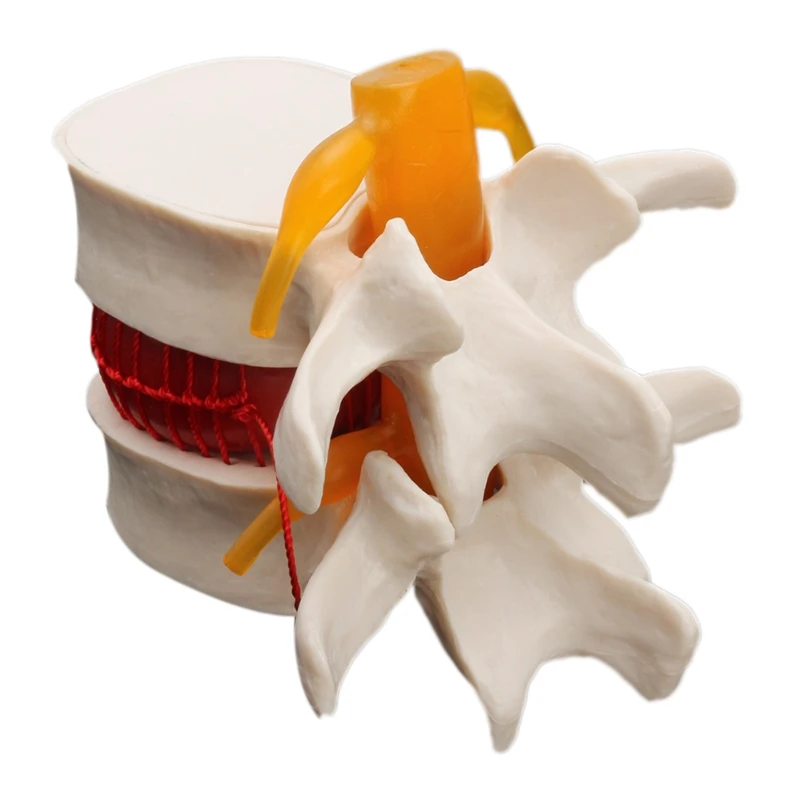 Human Anatomy Skeleton Spine Lumbar Disc Herniation Teaching Model Brain Skull Traumatic School Supplies Medical Instrume
Human Anatomy Skeleton Spine Lumbar Disc Herniation Teaching Model Brain Skull Traumatic School Supplies Medical Instrume