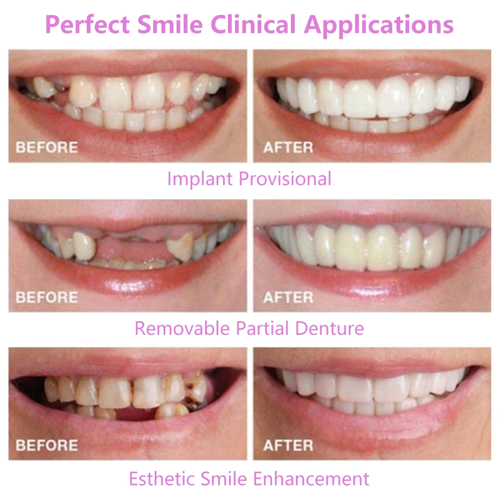 Cosmetic Denture Upper/Lower Snap on Smile Polyethylene Instant Veneers Fake Teeth Cover Simulation Braces Oral Care Beauty Tool
Cosmetic Denture Upper/Lower Snap on Smile Polyethylene Instant Veneers Fake Teeth Cover Simulation Braces Oral Care Beauty Tool