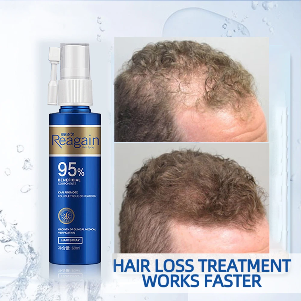 HAIRCUBE Hair Loss Prevention Hair Thickening Spray Thinning Hair Tonic for Fine Hair Thick Hair Growth Products for Men/Women
HAIRCUBE Hair Loss Prevention Hair Thickening Spray Thinning Hair Tonic for Fine Hair Thick Hair Growth Products for Men/Women