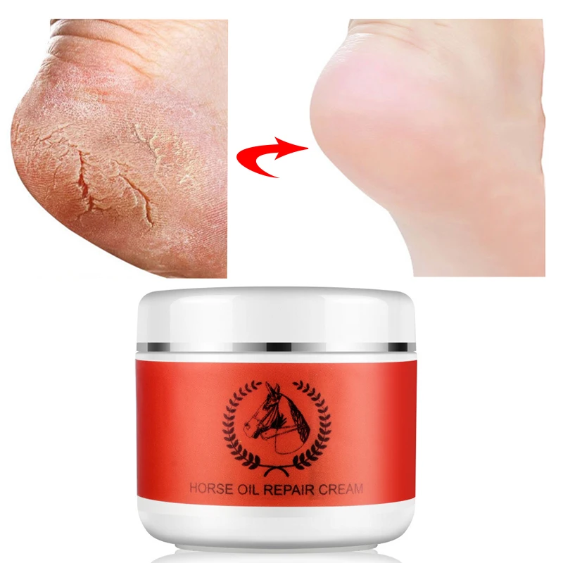 Horse Oil Foot Hand Cream Moisturizing Skin Care Relieve Dryness Anti Chapping Foot Mask Whitening Winter Beauty Health Products
Horse Oil Foot Hand Cream Moisturizing Skin Care Relieve Dryness Anti Chapping Foot Mask Whitening Winter Beauty Health Products