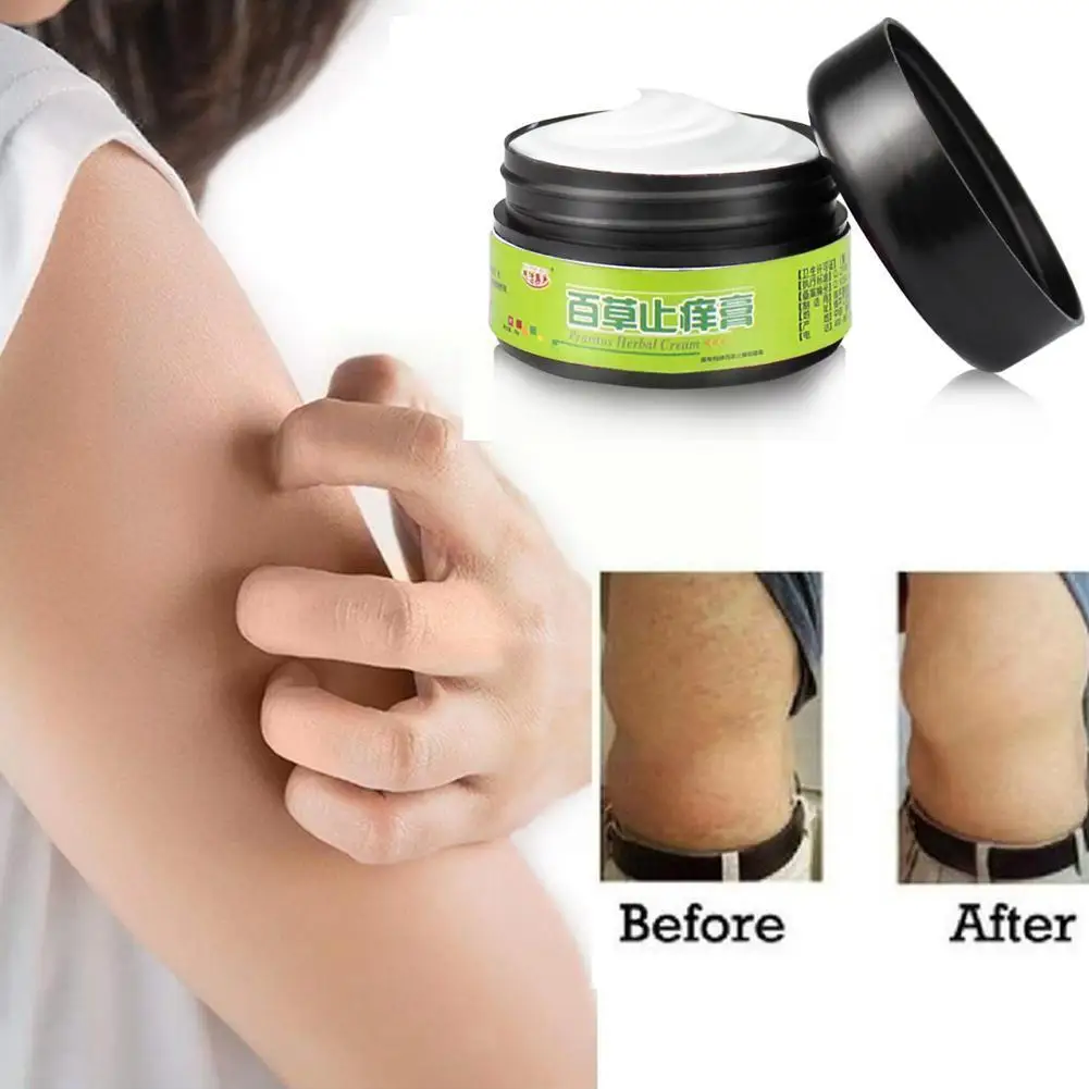 25g Natural Herbal Ointment Psoriasi Cream Effective For Dermatitis Psoriasis Eczema Cream Chinese Herbal Medicine D9x2
25g Natural Herbal Ointment Psoriasi Cream Effective For Dermatitis Psoriasis Eczema Cream Chinese Herbal Medicine D9x2
