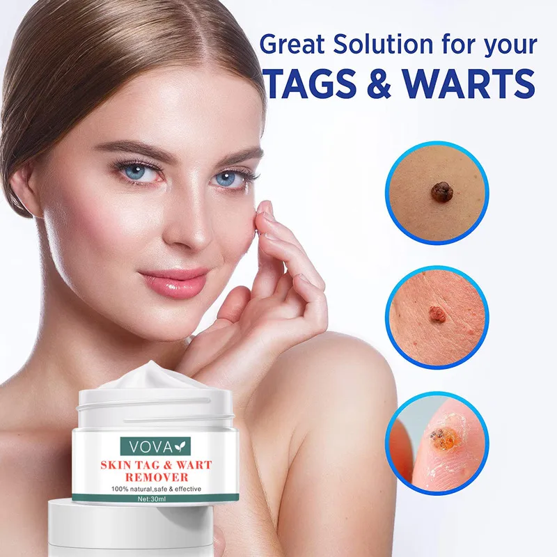 Skin Tage Warts Remove Cream Antibacterial Ointment Herbal Wart Treatment Cream Skin Tag Remove Corn Plaster Warts Ointment
Skin Tage Warts Remove Cream Antibacterial Ointment Herbal Wart Treatment Cream Skin Tag Remove Corn Plaster Warts Ointment