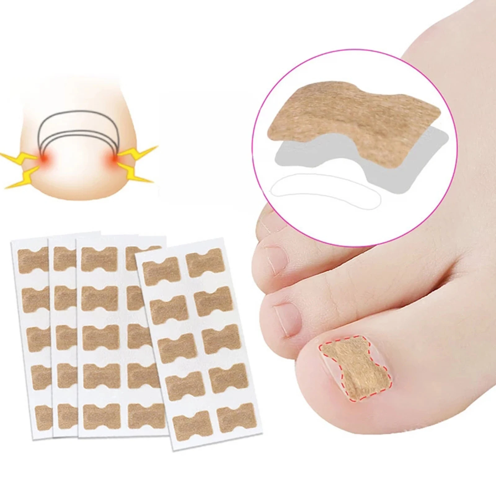 Foot Care Sticker Toenail Correction Sticker For Men Women Pedicure Foot Care Tools Ingrown Patch Nail Sulcus Correction Patch
Foot Care Sticker Toenail Correction Sticker For Men Women Pedicure Foot Care Tools Ingrown Patch Nail Sulcus Correction Patch
