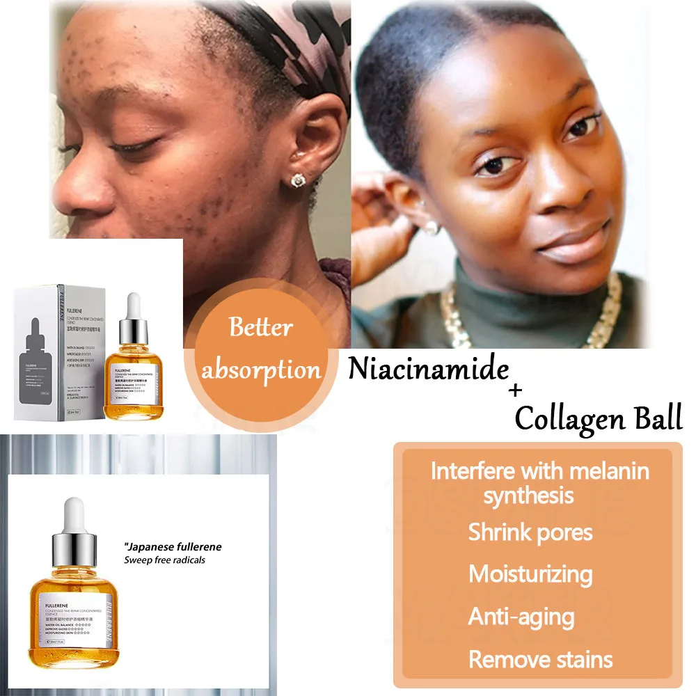Fullerene-Anti-Aging Skin Care Serum, Facial Whitening, Wrinkle Retardant, Spot Remover, Skin Blemish Purifying SERUM, 2%
Fullerene-Anti-Aging Skin Care Serum, Facial Whitening, Wrinkle Retardant, Spot Remover, Skin Blemish Purifying SERUM, 2%