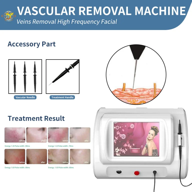 Laser Machine R-F Spider Veins Removal Machine Vascular Relieve Treatment R-F Wavelength E Lazer Varicose Blood Vessel Remove De
Laser Machine R-F Spider Veins Removal Machine Vascular Relieve Treatment R-F Wavelength E Lazer Varicose Blood Vessel Remove De