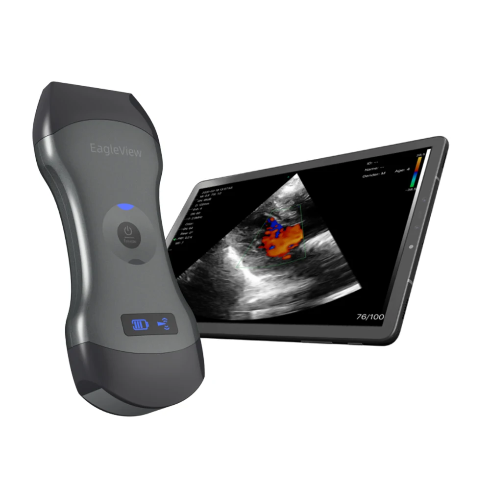 Wellue EagleView Wifi Probe Cardiac Sonoscape Physiotherapy Scanning Machine Portable Ultrasound
Wellue EagleView Wifi Probe Cardiac Sonoscape Physiotherapy Scanning Machine Portable Ultrasound