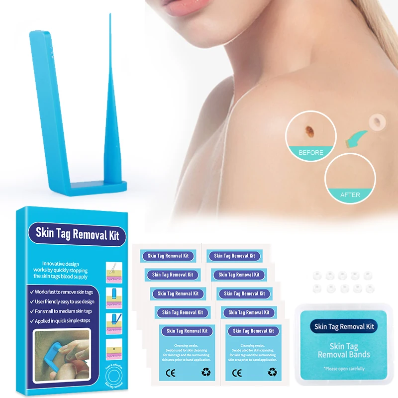 Skin Tag Removal Kit Mini Micro Skin Tag Treatment Tool Skin Facial Care Mole Wart Remover with Cleaning Swabs Easy To Clean
Skin Tag Removal Kit Mini Micro Skin Tag Treatment Tool Skin Facial Care Mole Wart Remover with Cleaning Swabs Easy To Clean