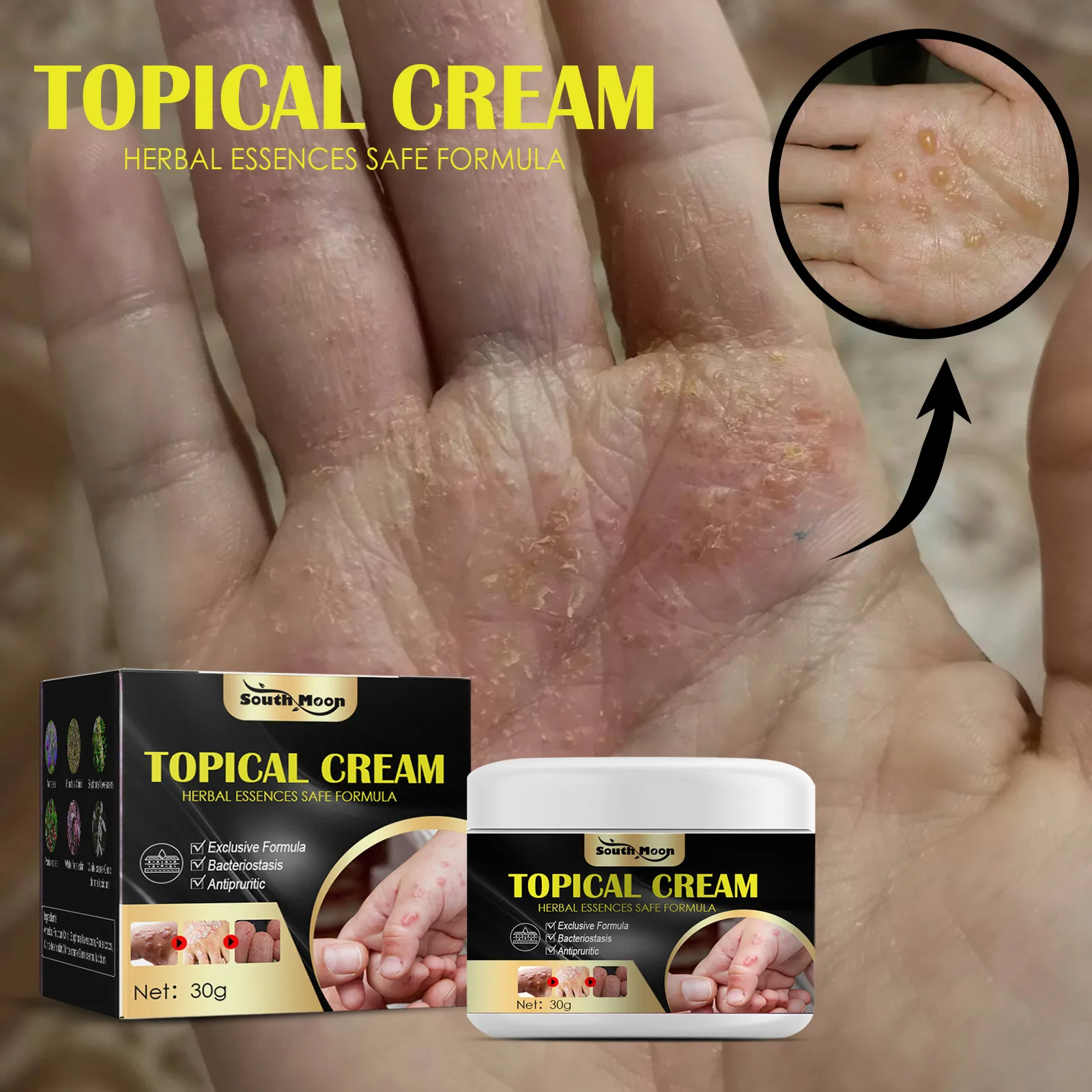 Blister hand and foot antipruritic cream skin dry itching mosquito bite antipruritic cream Repair Cream Skin antipruritic cream
Blister hand and foot antipruritic cream skin dry itching mosquito bite antipruritic cream Repair Cream Skin antipruritic cream