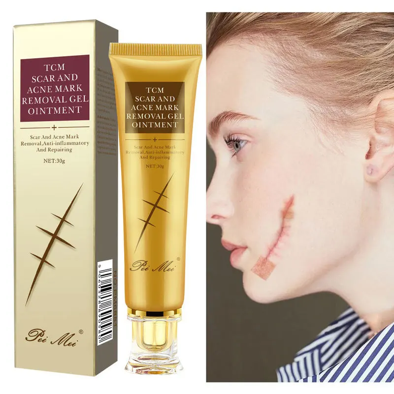 Acne Scar Removal Cream Serum Stretch Marks Pimples Spots Repair Treatment Whitening Moisturizing Body Skin Care 30g
Acne Scar Removal Cream Serum Stretch Marks Pimples Spots Repair Treatment Whitening Moisturizing Body Skin Care 30g