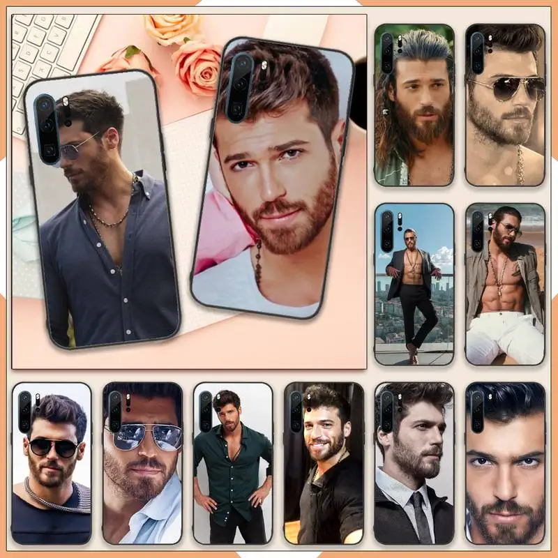 Turkish actors can yaman Phone Case For Huawei honor Mate 10 20 30 40 i 9 8 pro x Lite P smart 2019 Y5 2018 nova 5t
Turkish actors can yaman Phone Case For Huawei honor Mate 10 20 30 40 i 9 8 pro x Lite P smart 2019 Y5 2018 nova 5t