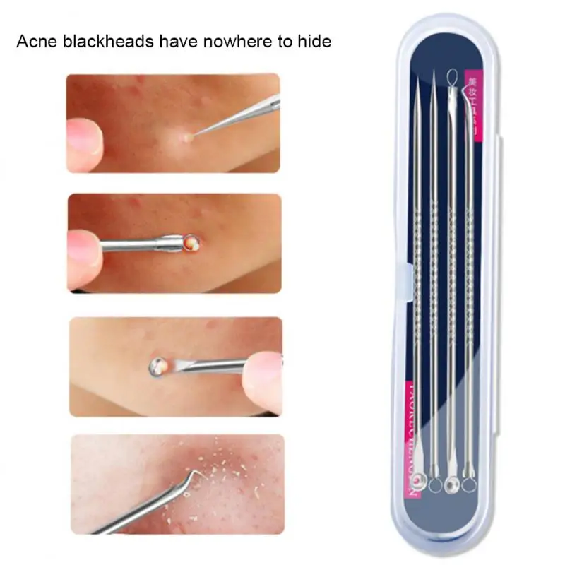 

4pcs Stainless Steel Blackhead Comedone Acne Blemish Extractor Remover Face Skin Care Pore Cleaner Needles Remove Tools Hot