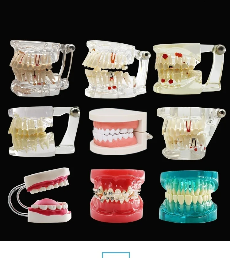 

Full Set Model Dental Teaching Model Doctor-patient Communication Model Removable Dental Model Implant Restoration Model Dental