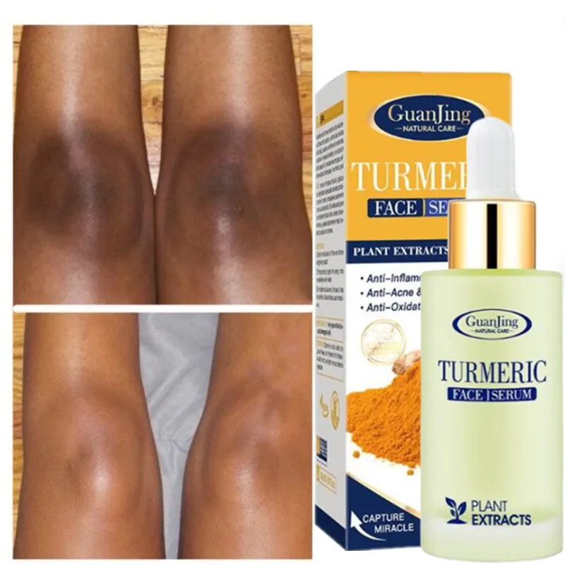 Turmeric Lemon Oil Skin Glow To Lightening Acne Dark Patches, Acne Bright Skin Dark Spot Corrector Face Whitening Serum
Turmeric Lemon Oil Skin Glow To Lightening Acne Dark Patches, Acne Bright Skin Dark Spot Corrector Face Whitening Serum