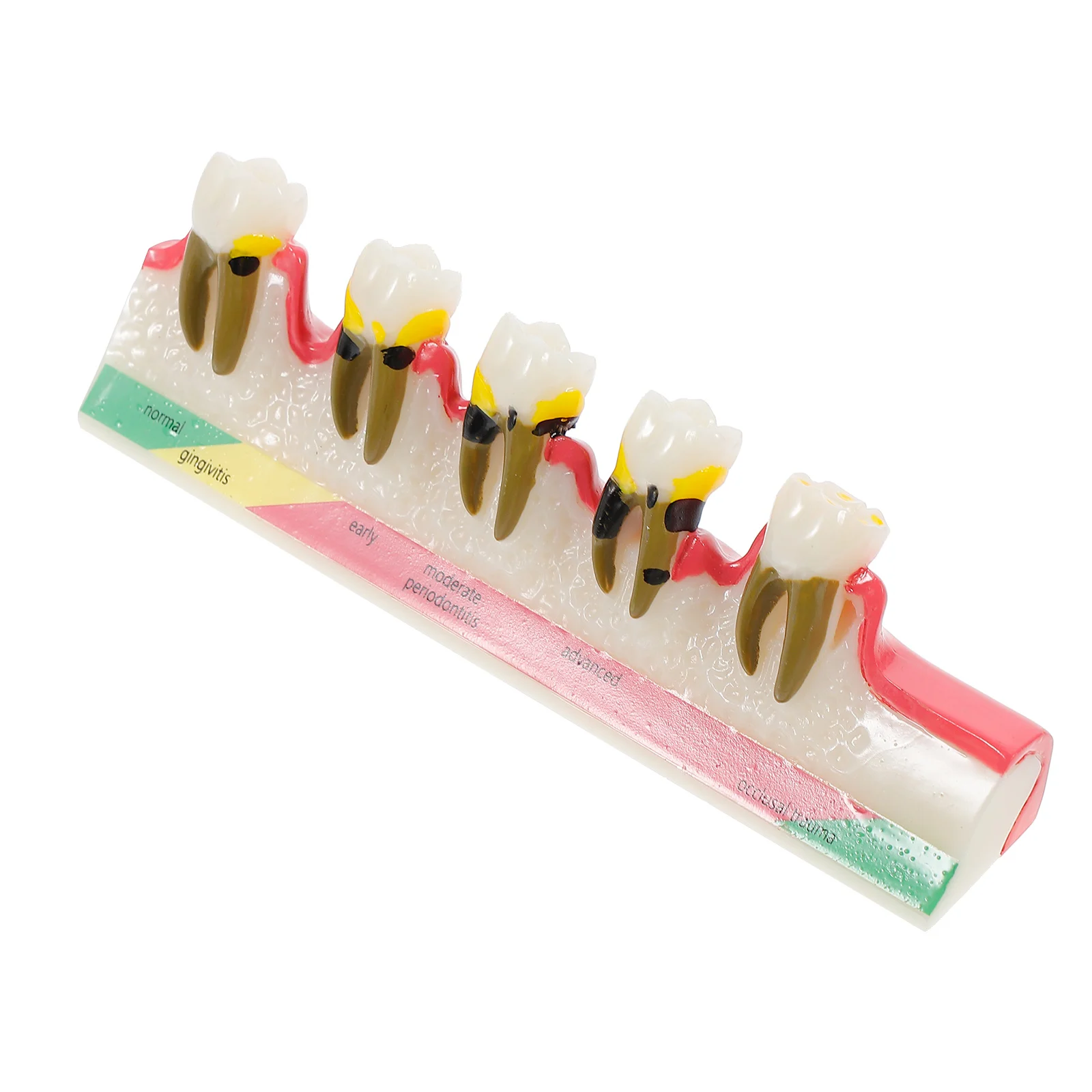 Periodontal Disease Assort Teeth Model Typodont Study Teaching Model for
Periodontal Disease Assort Teeth Model Typodont Study Teaching Model for