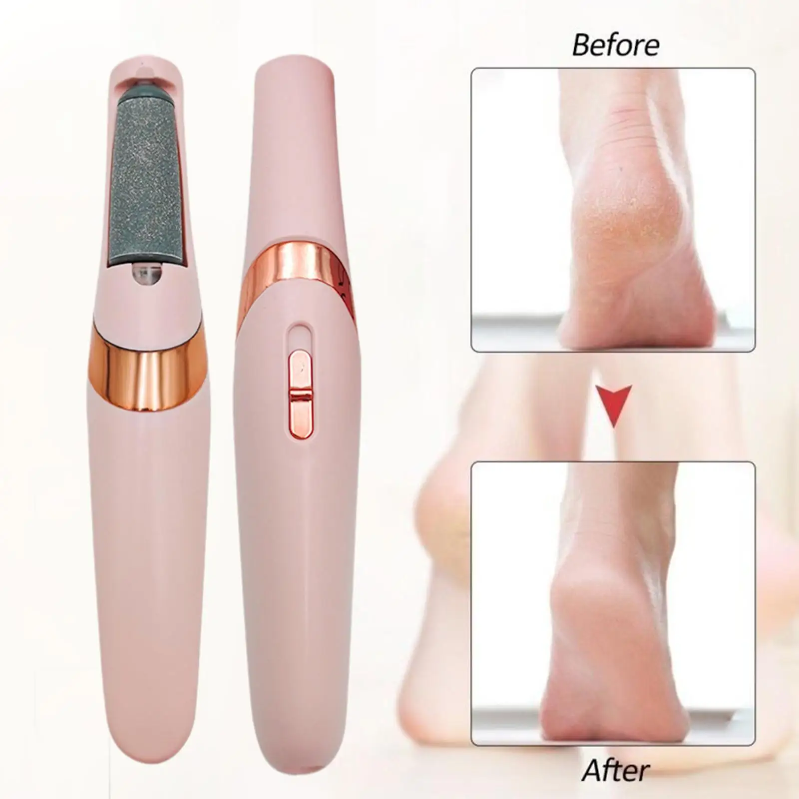 New Electric Foot File Pedicure Tools Dead Skin Callus Remover Skin Care Tools USB Pedicure Machine Portable Foot Care Tool
New Electric Foot File Pedicure Tools Dead Skin Callus Remover Skin Care Tools USB Pedicure Machine Portable Foot Care Tool