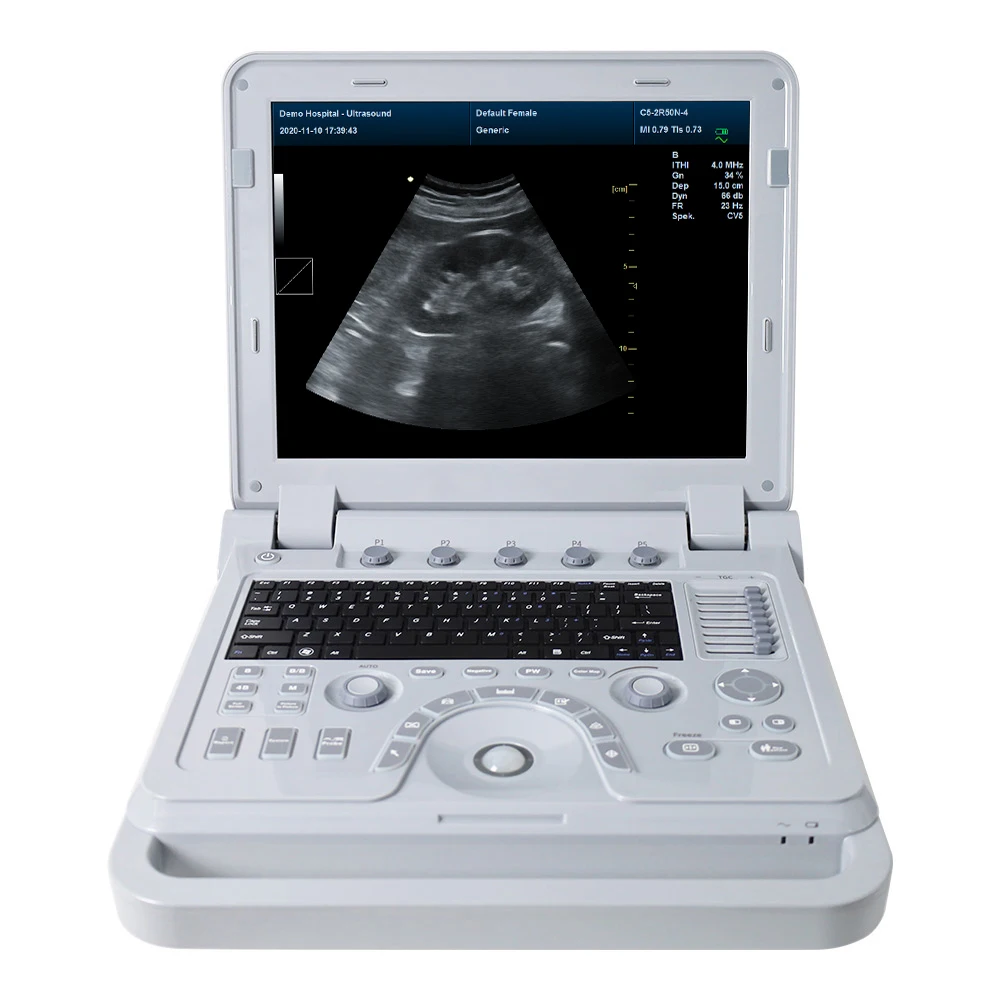 CONTEC CE CMS600P2PLUS Digital Notebook China ultrasound diagnostic system portable ultrasound scanner device
CONTEC CE CMS600P2PLUS Digital Notebook China ultrasound diagnostic system portable ultrasound scanner device