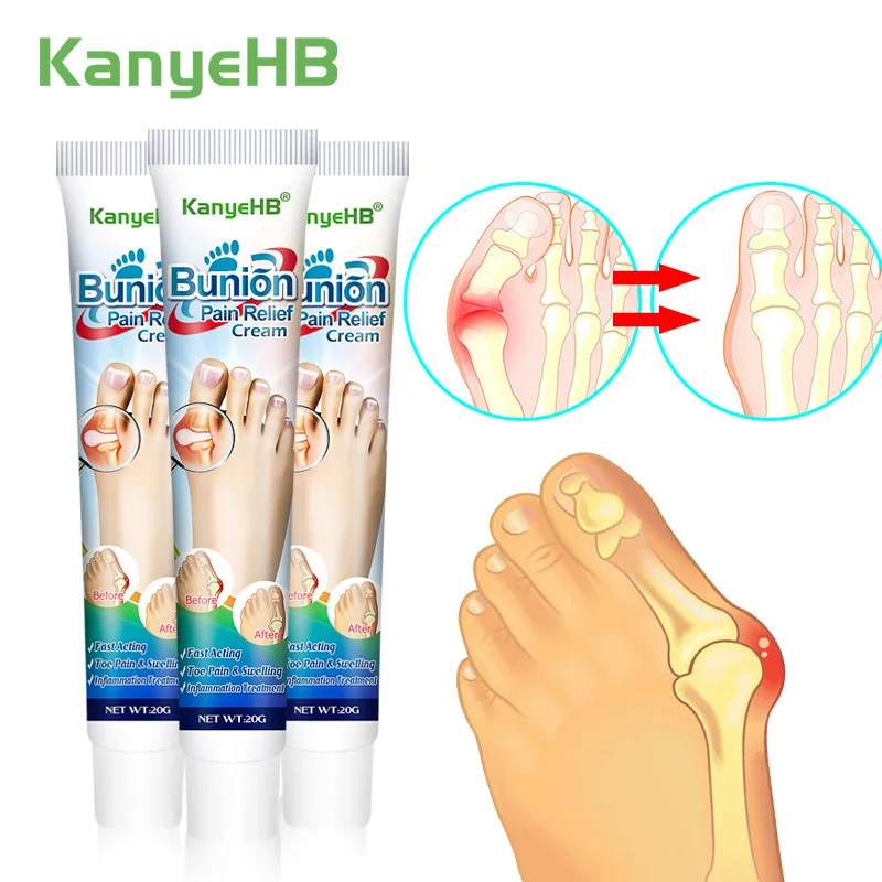 3pcs Bunion Pain Relief Cream Toe Hallux Valgus Joint Pain Relief Ointment CureToe Periostitis Gout Foot Medical Plasters A990
3pcs Bunion Pain Relief Cream Toe Hallux Valgus Joint Pain Relief Ointment CureToe Periostitis Gout Foot Medical Plasters A990