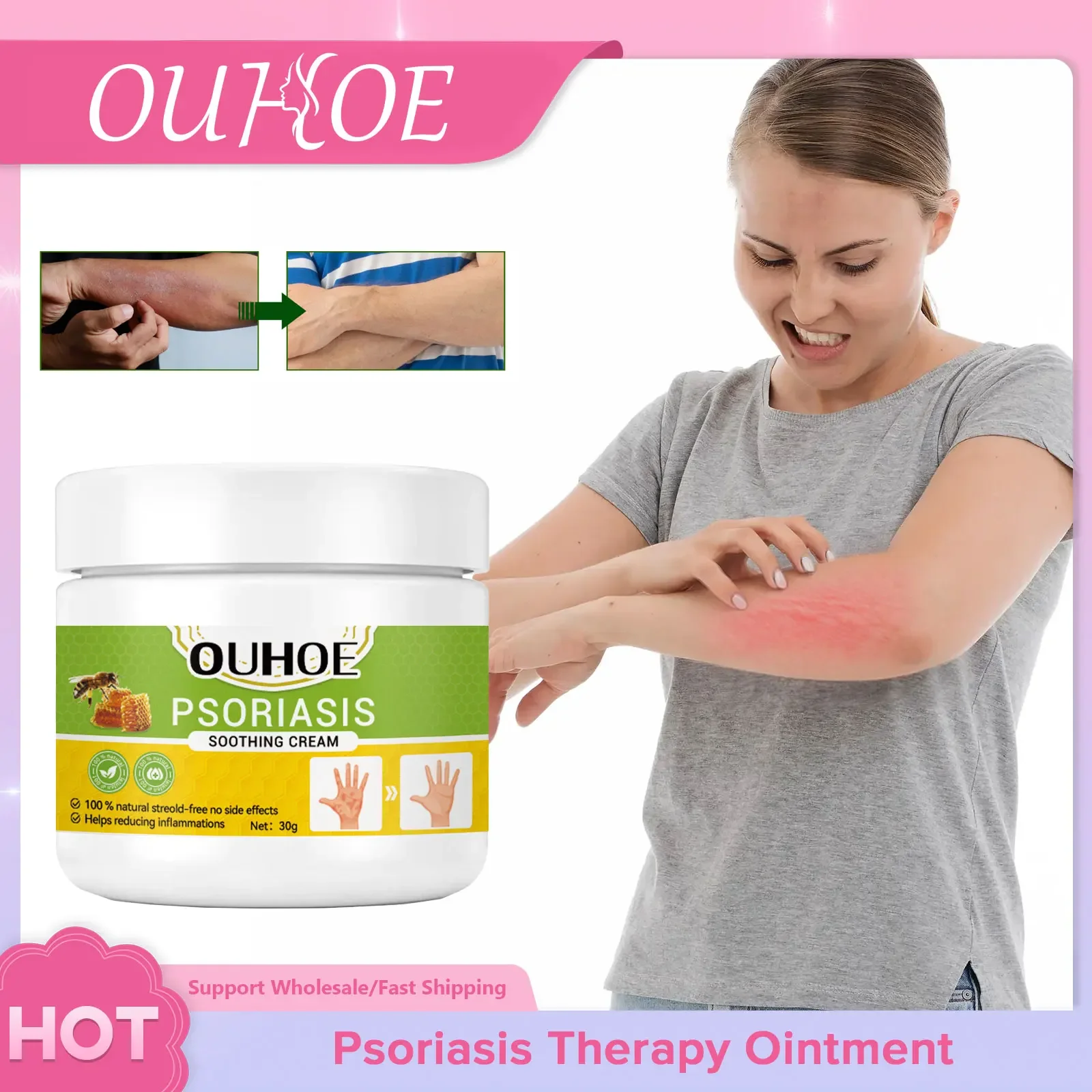 Psoriasis Treatment Cream Repair Eczema Reduce Inflammation Itching Relief Anti Red Rash Dermatitis Relieving Massage Ointment
Psoriasis Treatment Cream Repair Eczema Reduce Inflammation Itching Relief Anti Red Rash Dermatitis Relieving Massage Ointment