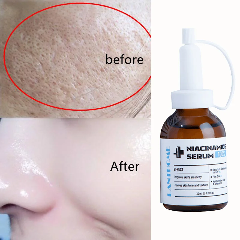Niacinamide Face Whitening Serum Hyaluronic Acid Moisturizing Shrink Pores Improve Acnes Blackheads Oil Control Facial Skin Care
Niacinamide Face Whitening Serum Hyaluronic Acid Moisturizing Shrink Pores Improve Acnes Blackheads Oil Control Facial Skin Care