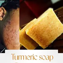 Turmeric Soap Bar Face Cleansing Anti Acne Skin Brighten Remove Pimples Dark Spot Lightening Ginger Essential Oil Body Bath