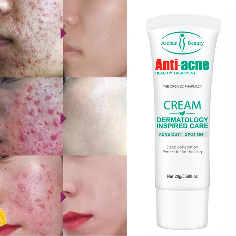 Acne Removal Cream Remove Pimple Acne Scar Cream Herbal Acne Spots Oil Control Gel Whitening Moisturizing Smooth Skin Care 20g
Acne Removal Cream Remove Pimple Acne Scar Cream Herbal Acne Spots Oil Control Gel Whitening Moisturizing Smooth Skin Care 20g