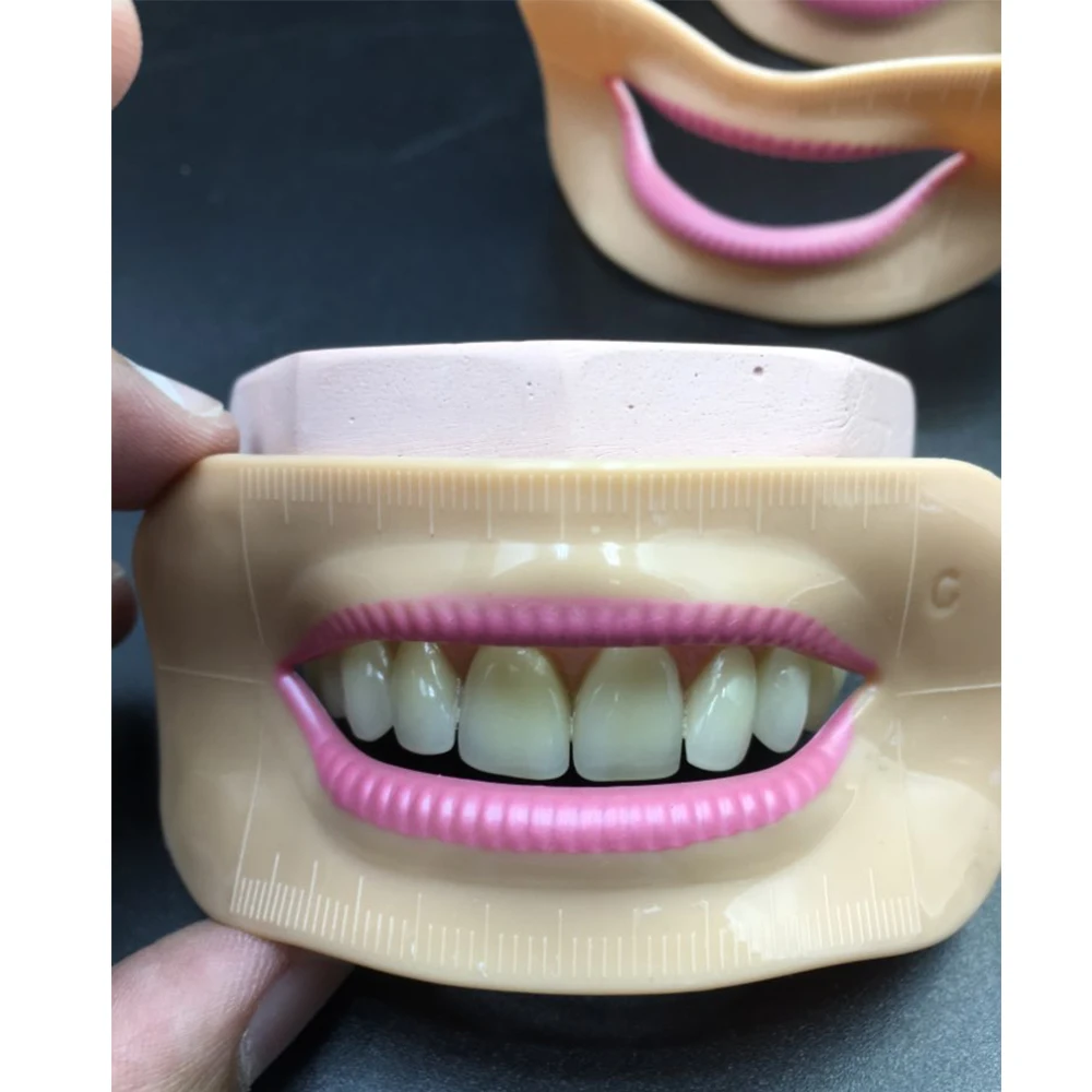 Dental lab denture laboratory mouth measuring lip measurement tool aesthetics parts 4 pcs different shape
Dental lab denture laboratory mouth measuring lip measurement tool aesthetics parts 4 pcs different shape
