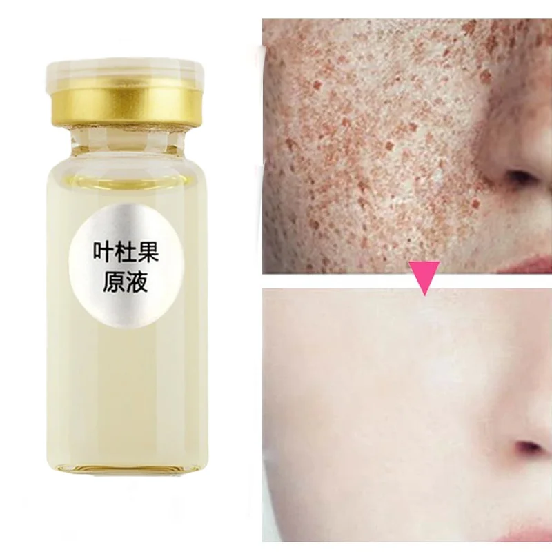 Korean Face Whitening Freckle Solution Remove Dark Spots Melanin Melasma Brighten Pigmentation Anti-Aging Cream Skin Care
Korean Face Whitening Freckle Solution Remove Dark Spots Melanin Melasma Brighten Pigmentation Anti-Aging Cream Skin Care