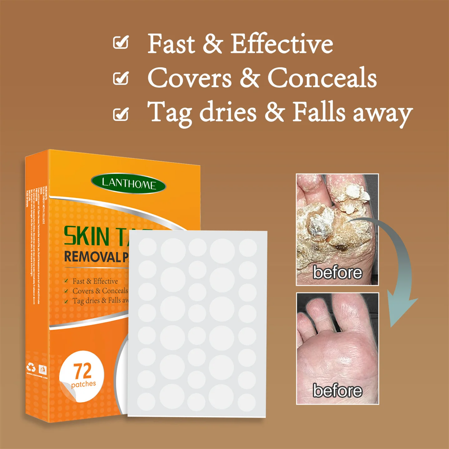 1 коробка 72 шт., бородавки и Пластыри для удаления бородавок и бородавок
1 коробка 72 шт., бородавки и Пластыри для удаления бородавок и бородавок