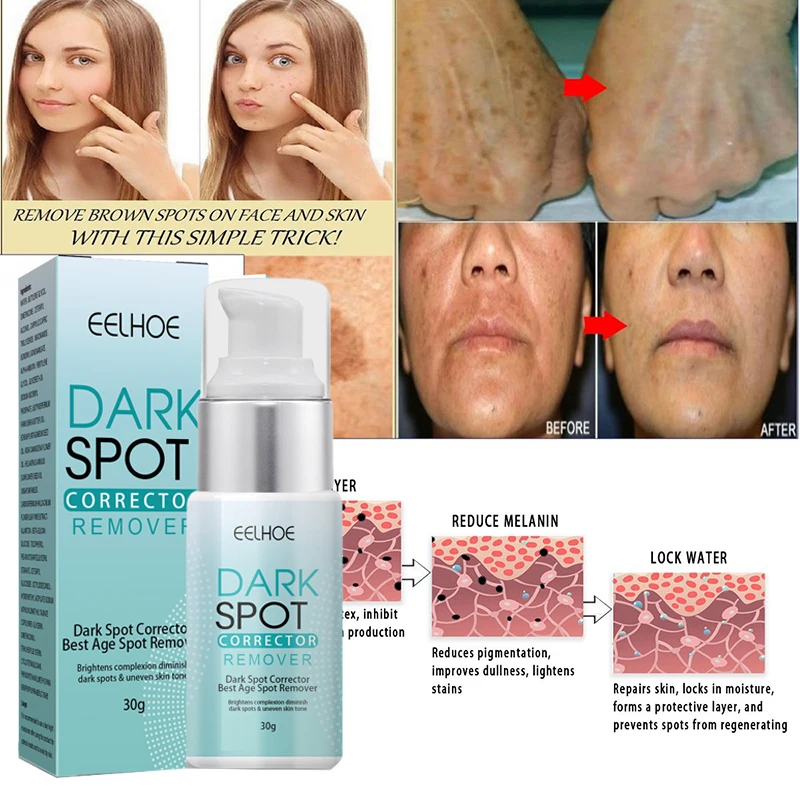 Freckle Whitening Cream Moisturizes The Face, Removing Black Spots, Melanin, Freckle, Whitening Skin, Anti-aging. Snail
Freckle Whitening Cream Moisturizes The Face, Removing Black Spots, Melanin, Freckle, Whitening Skin, Anti-aging. Snail