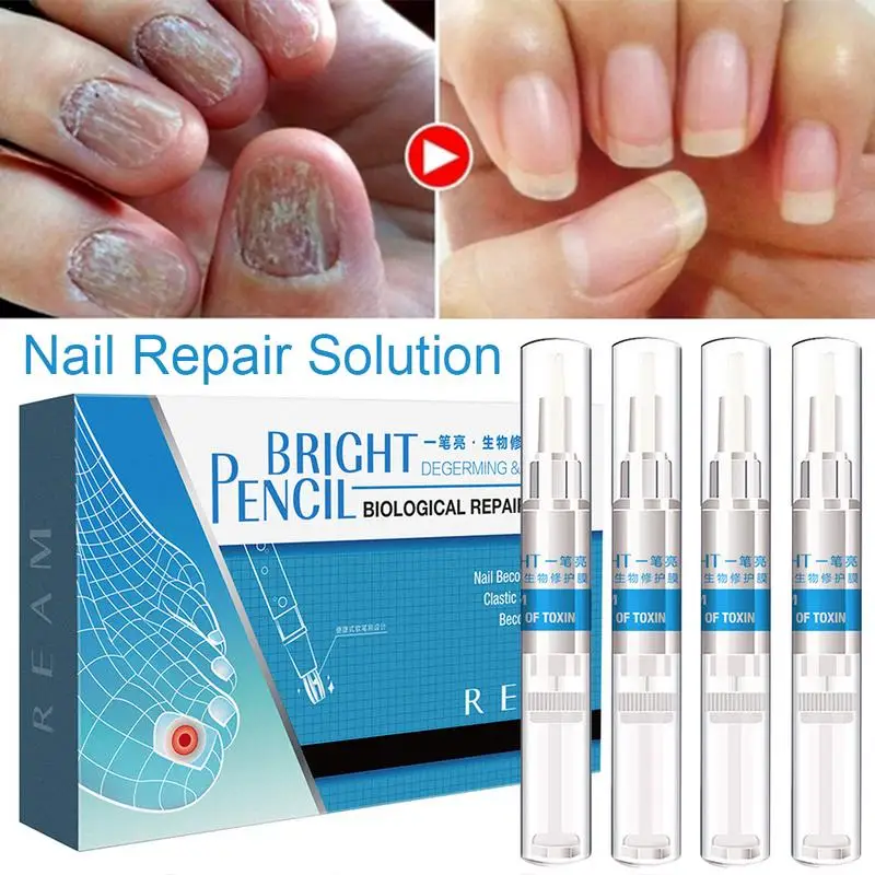 Перо для ремонта ногтей продукты онихомикоз паронихия против ногтей китайская травяная масляная ручка для ухода за ногтями
Перо для ремонта ногтей продукты онихомикоз паронихия против ногтей китайская травяная масляная ручка для ухода за ногтями