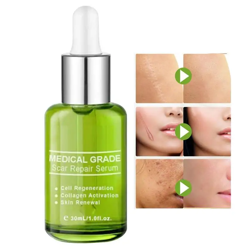 Scar Guards Repair Liquid 1.01oz Scar Repair Liquid With Water Allantoin Aloe Extract Surgical Fall Scars Repair Essence Bottle
Scar Guards Repair Liquid 1.01oz Scar Repair Liquid With Water Allantoin Aloe Extract Surgical Fall Scars Repair Essence Bottle