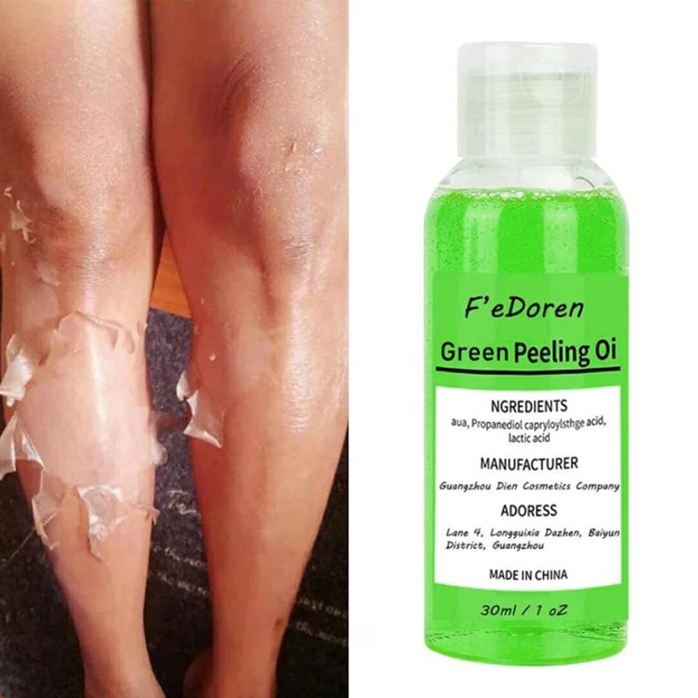 Whitening Body Yellow Peeling Oil Dark Spot Remover Skin Bleaching Brightening Oil Deep Exfoliating Serum For Face Body 30/50ML
Whitening Body Yellow Peeling Oil Dark Spot Remover Skin Bleaching Brightening Oil Deep Exfoliating Serum For Face Body 30/50ML