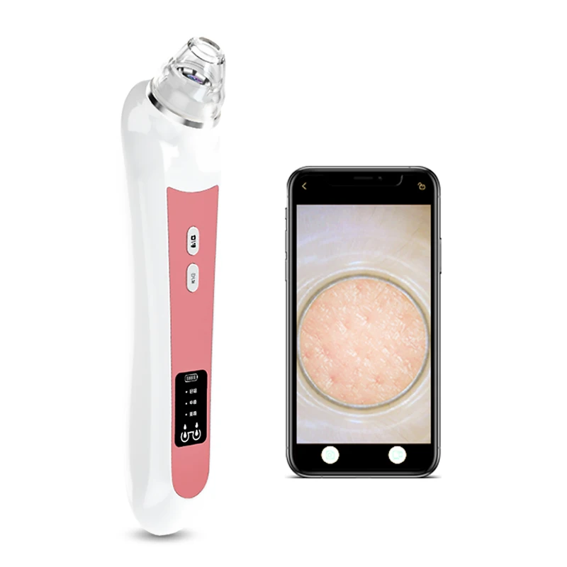 Timesiso H200 facial blackhead removal machine 20X visual electronic blackhead remover
Timesiso H200 facial blackhead removal machine 20X visual electronic blackhead remover