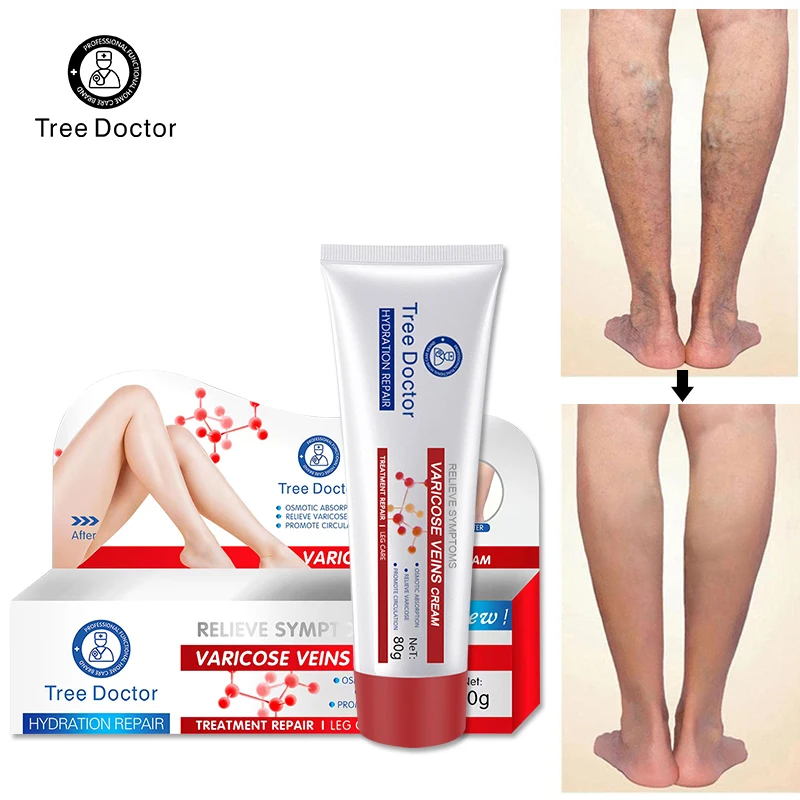 80g Relief Varicose Vein Cream Effective Relieve Spider Legs Dilated Vasculitis Phlebitis Natural Formula Ointment For Body Care
80g Relief Varicose Vein Cream Effective Relieve Spider Legs Dilated Vasculitis Phlebitis Natural Formula Ointment For Body Care